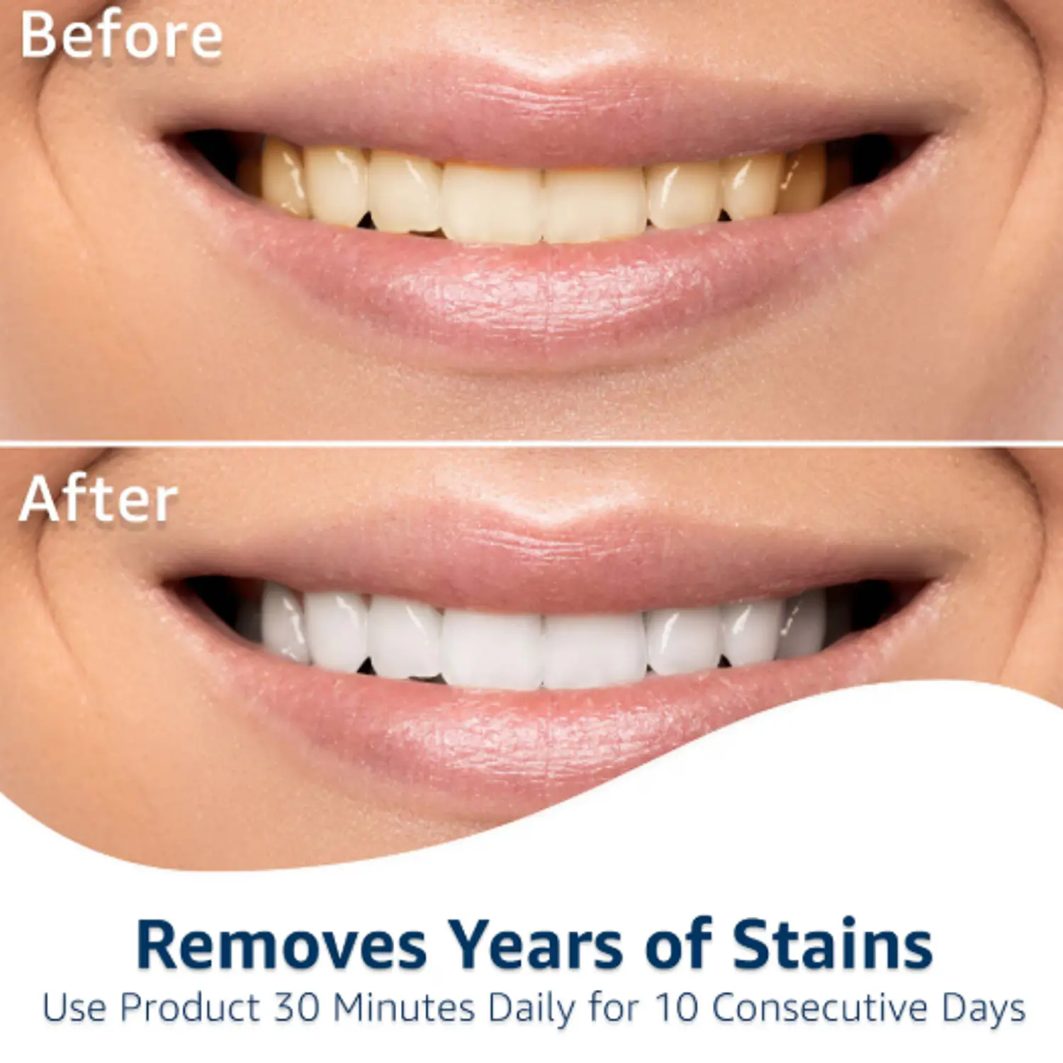 Tiras blanqueadoras dentales Equate preventa 2