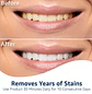 Tiras blanqueadoras dentales Equate preventa - Miniatura 2