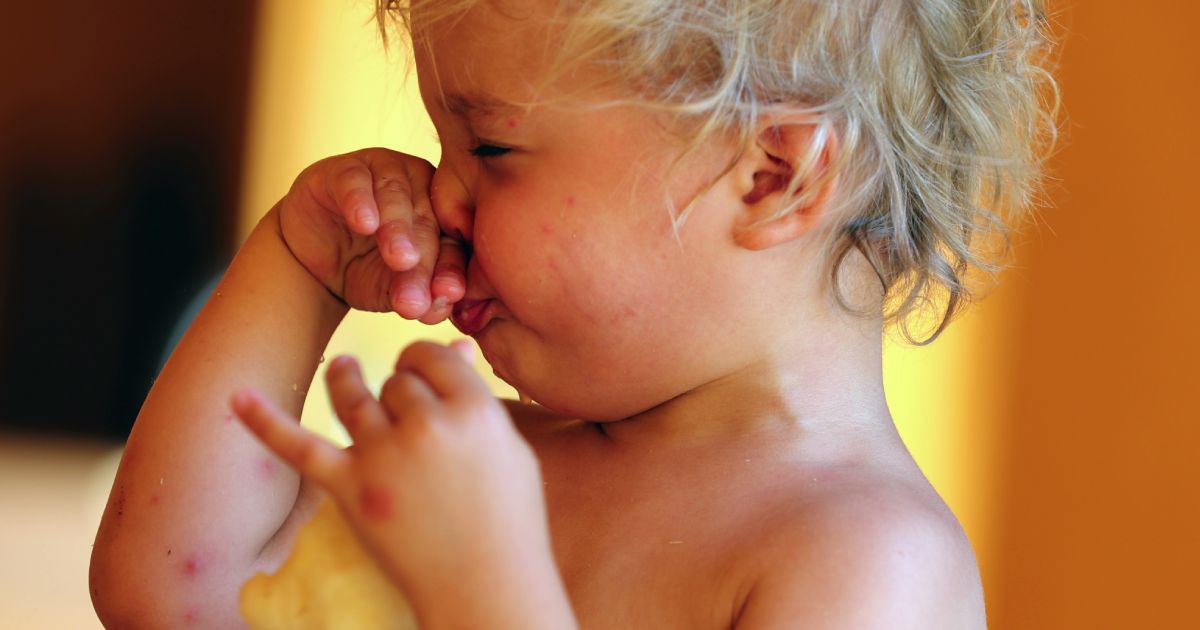 Cómo prevenir una alergia alimentaria al alimentar a tu bebé