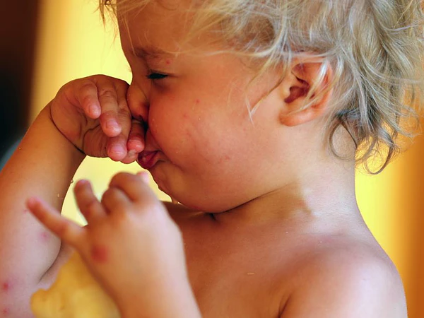 Cómo prevenir una alergia alimentaria al alimentar a tu bebé