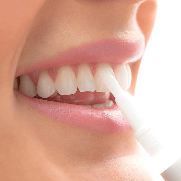 Pack 2x Lápis Branqueador Dental - INNOVAGOODS 3
