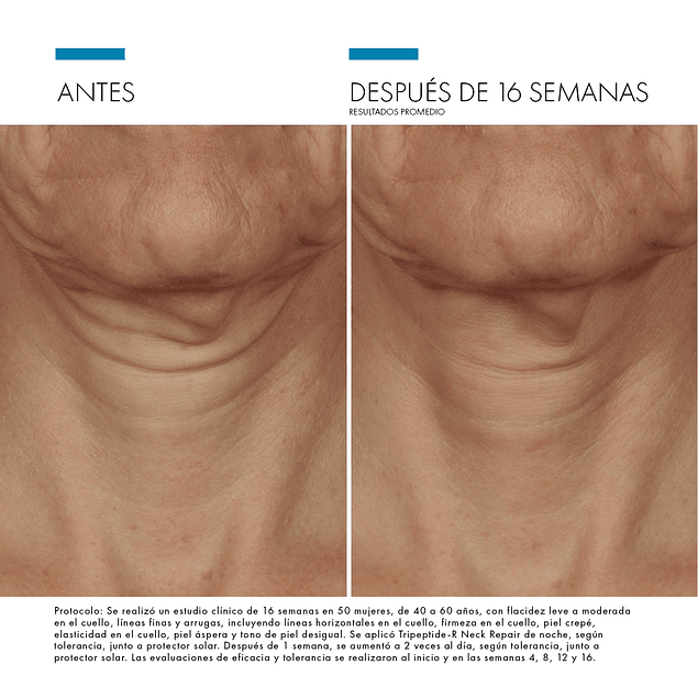 TRIPEPTIDE-R NECK REPAIR