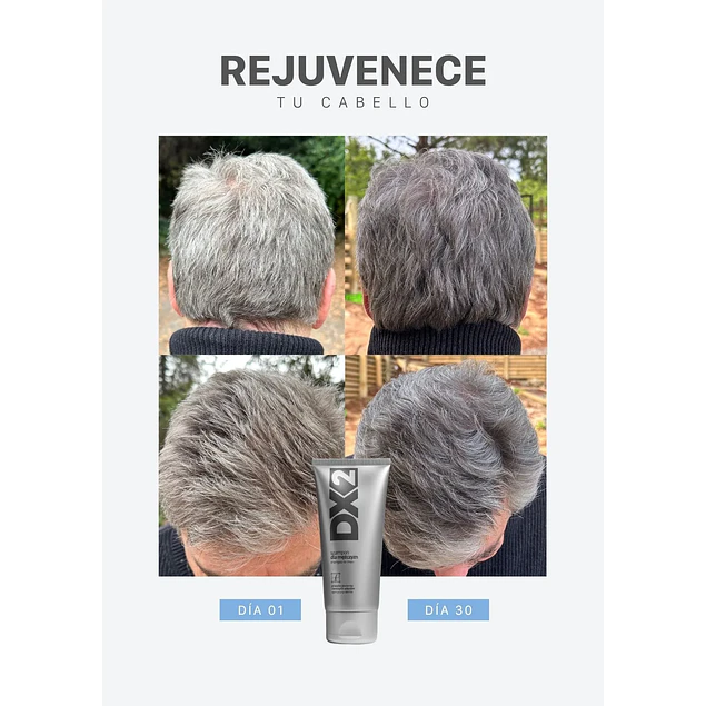 DX2 Shampoo Anti - Canas