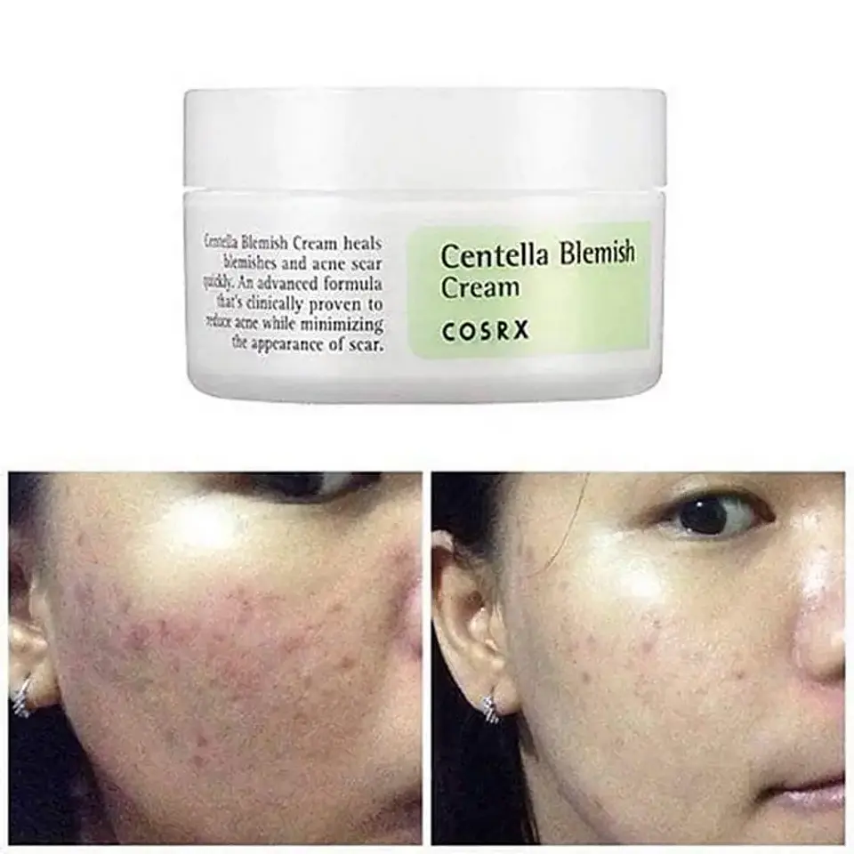  Centella Blemish Cream 3
