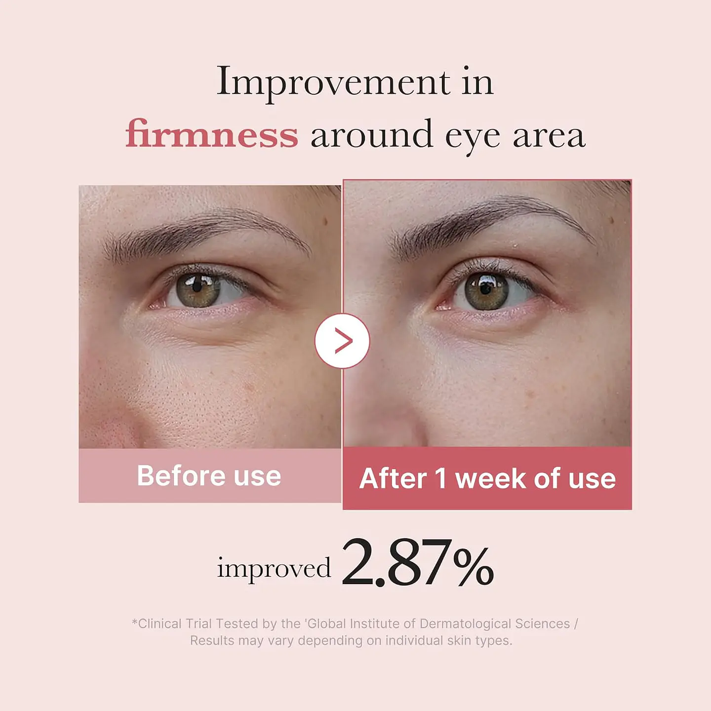 PDRN Pink Peptide Eye Serum – Contorno de Ojos 30 ml 4