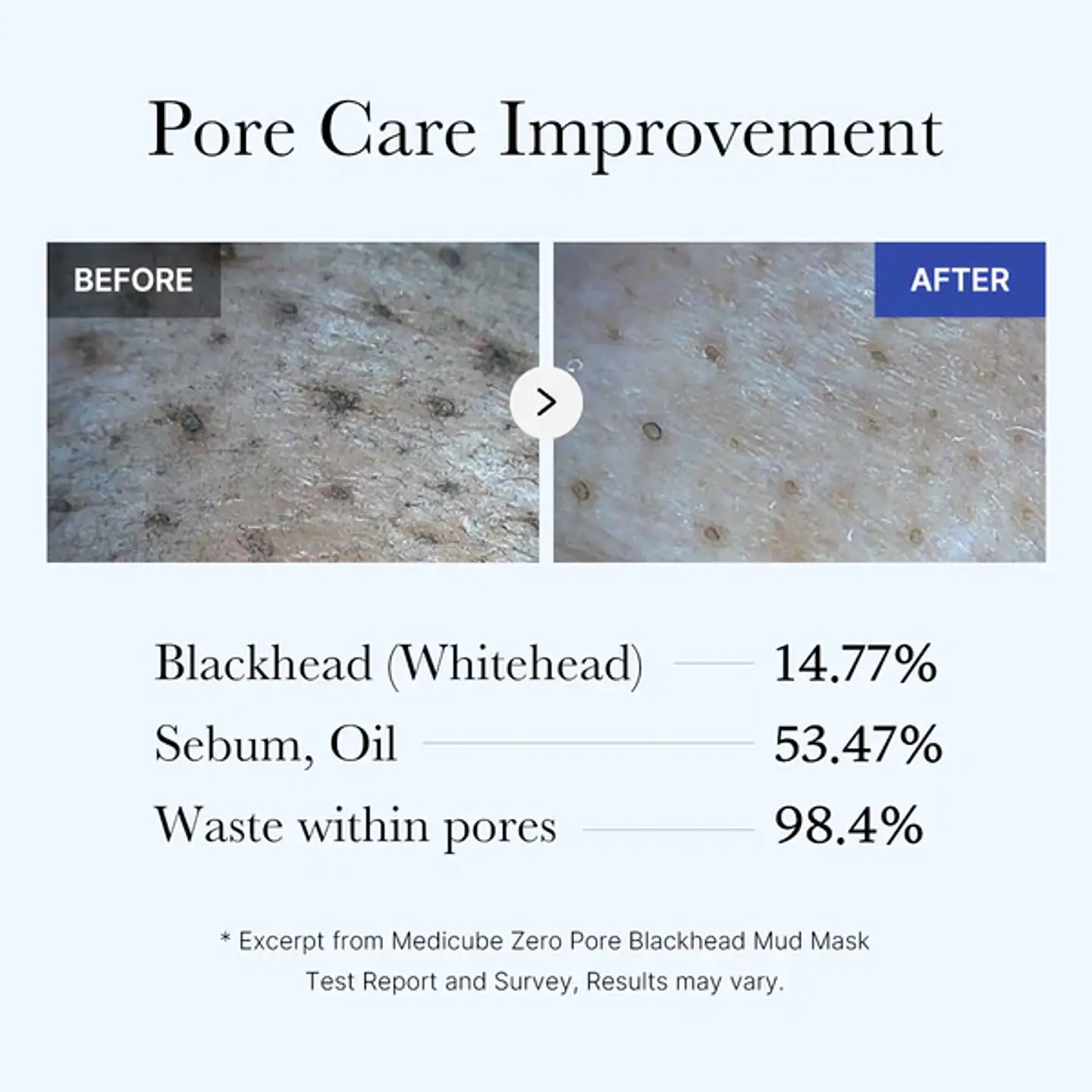 Zero Pore Mascarilla Puntos Negros 100g 6