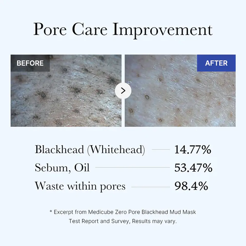 Zero Pore Mascarilla Puntos Negros 100g 6