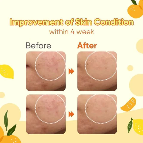 COMMONLABS Vitamin C – Crema Gel 50ml