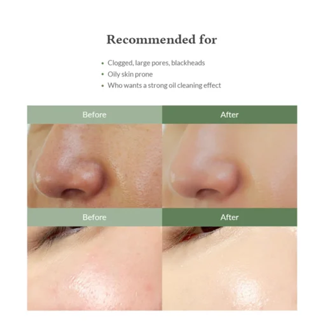 Quick Step Sebum Cleanser – Ablandador y Removedor de Puntos negros – 100ml 2