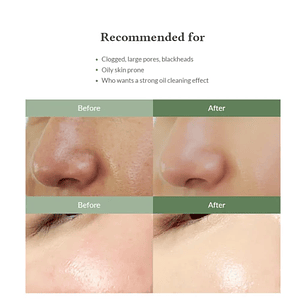 Quick Step Sebum Cleanser – Ablandador y Removedor de Puntos negros – 100ml