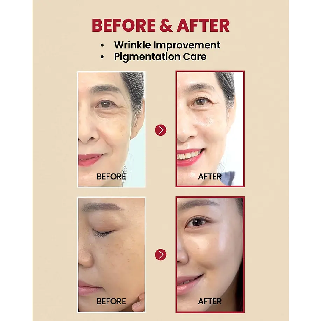 SEOUL 1988 Serum : Retinal Liposome 2% + Black Ginseng 30ml 6