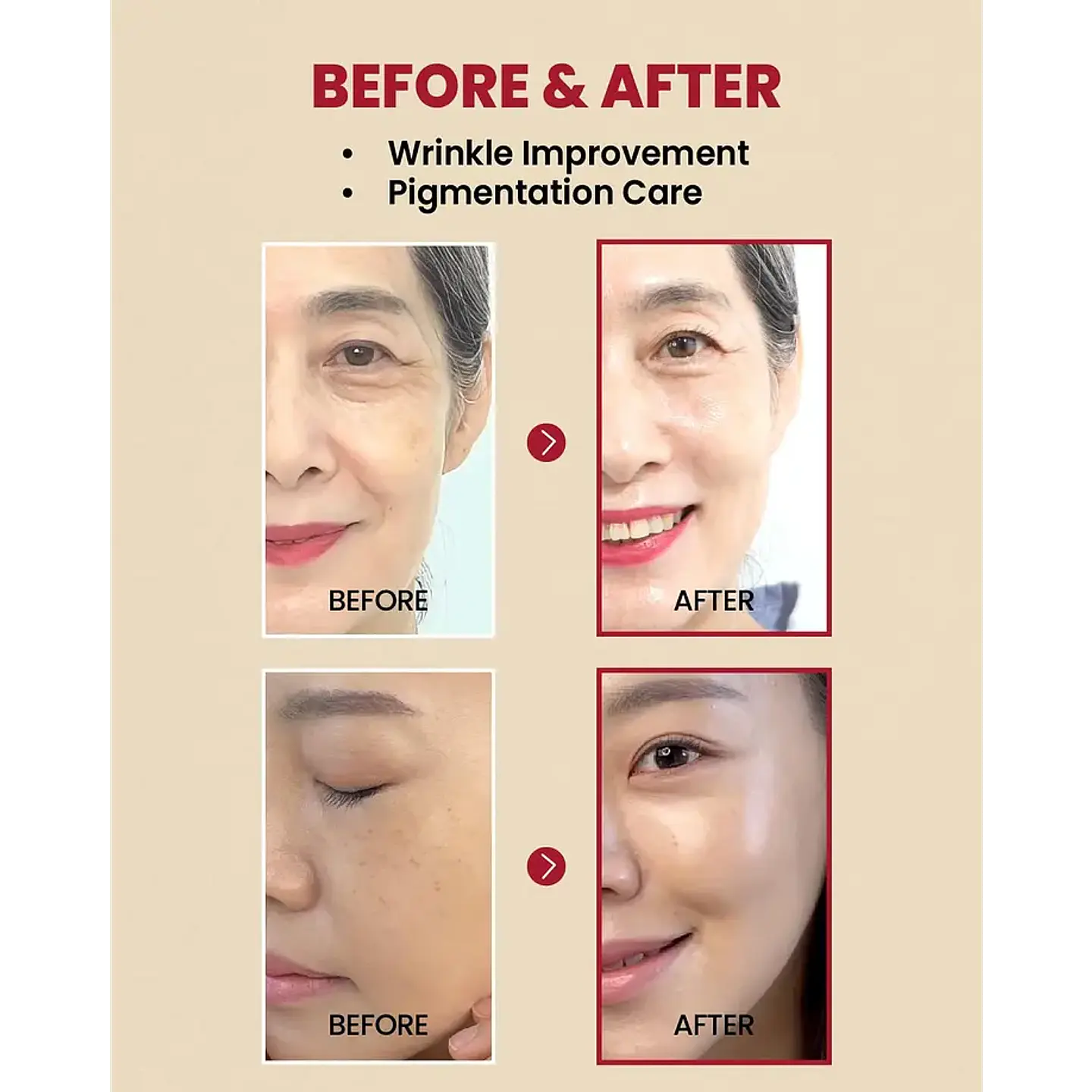 SEOUL 1988 Serum : Retinal Liposome 2% + Black Ginseng 30ml 6