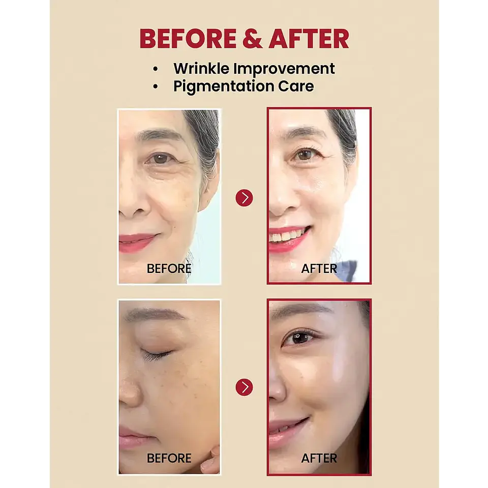 SEOUL 1988 Serum : Retinal Liposome 2% + Black Ginseng 30ml 6