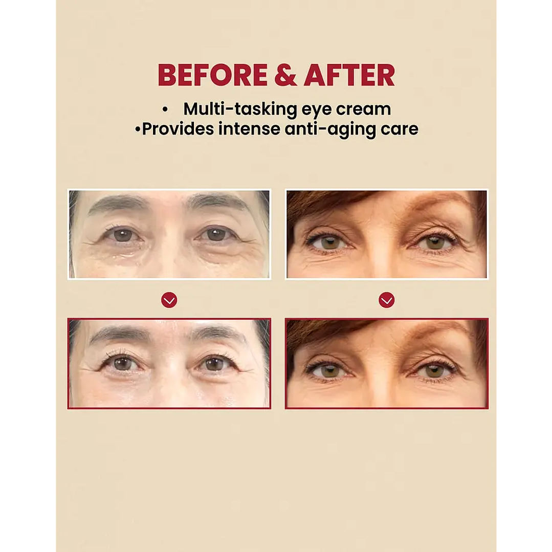 SEOUL 1988 Eye Cream : Retinal Liposome 4% + Fermented Bean 30ml 4