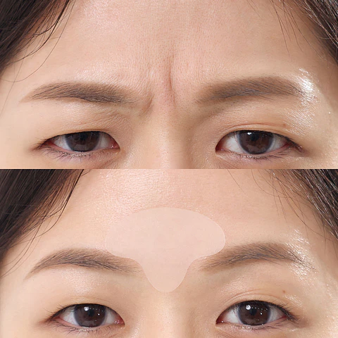 Wrinkle Master Patch: T-Zone (parches anti arrugas)