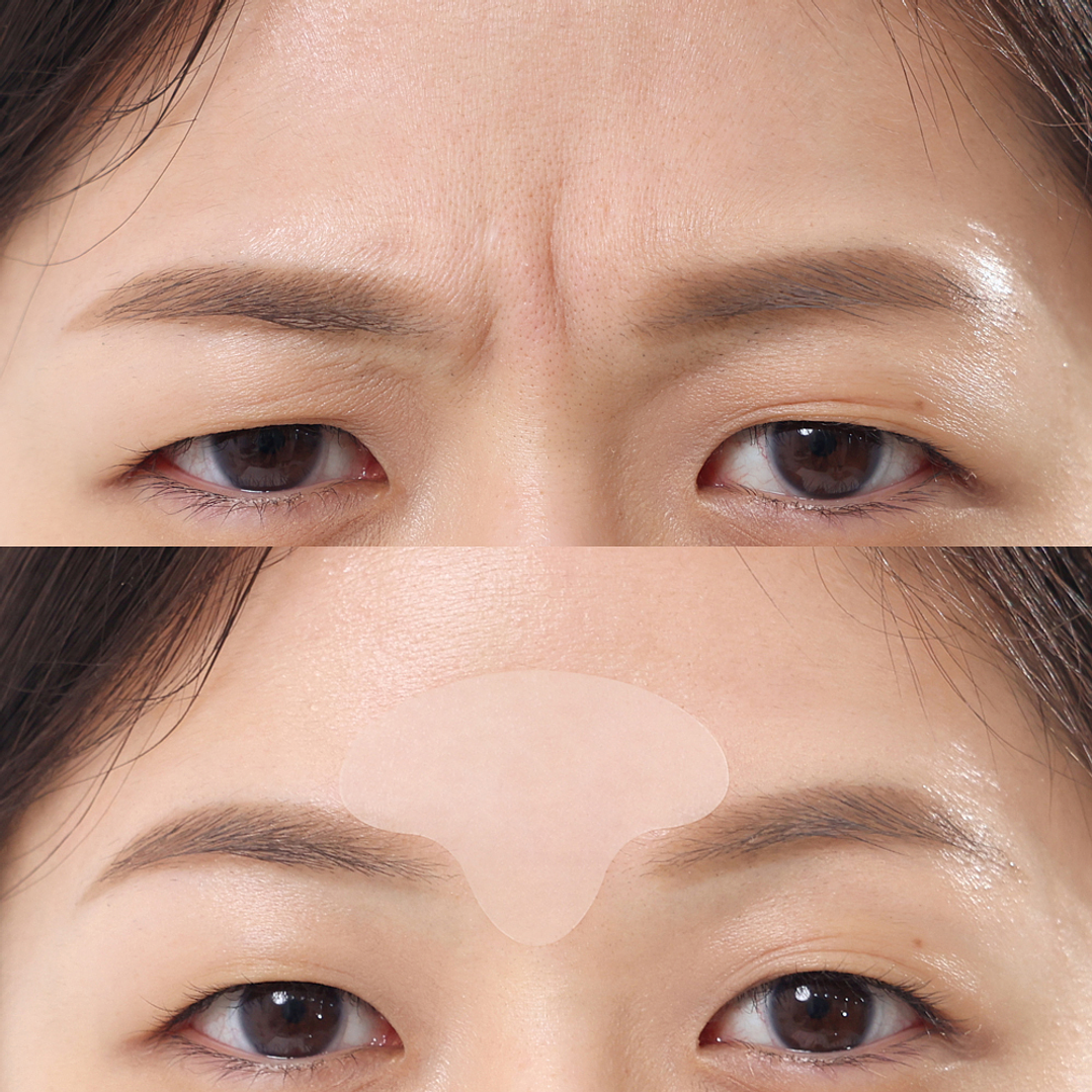 Wrinkle Master Patch: T-Zone (parches anti arrugas) 2