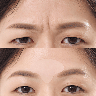 Wrinkle Master Patch: T-Zone (parches anti arrugas)