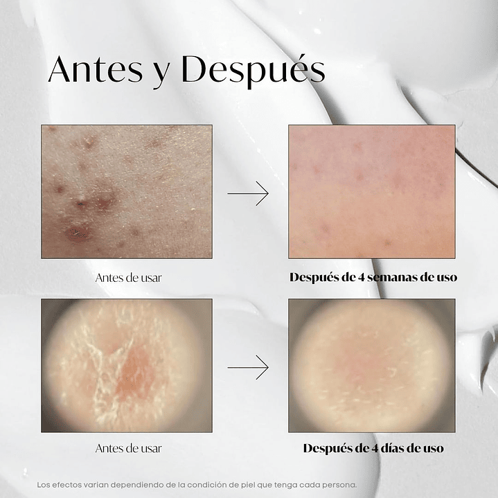 VT 300 Reedle Shot Pouch (1 sobre) 5