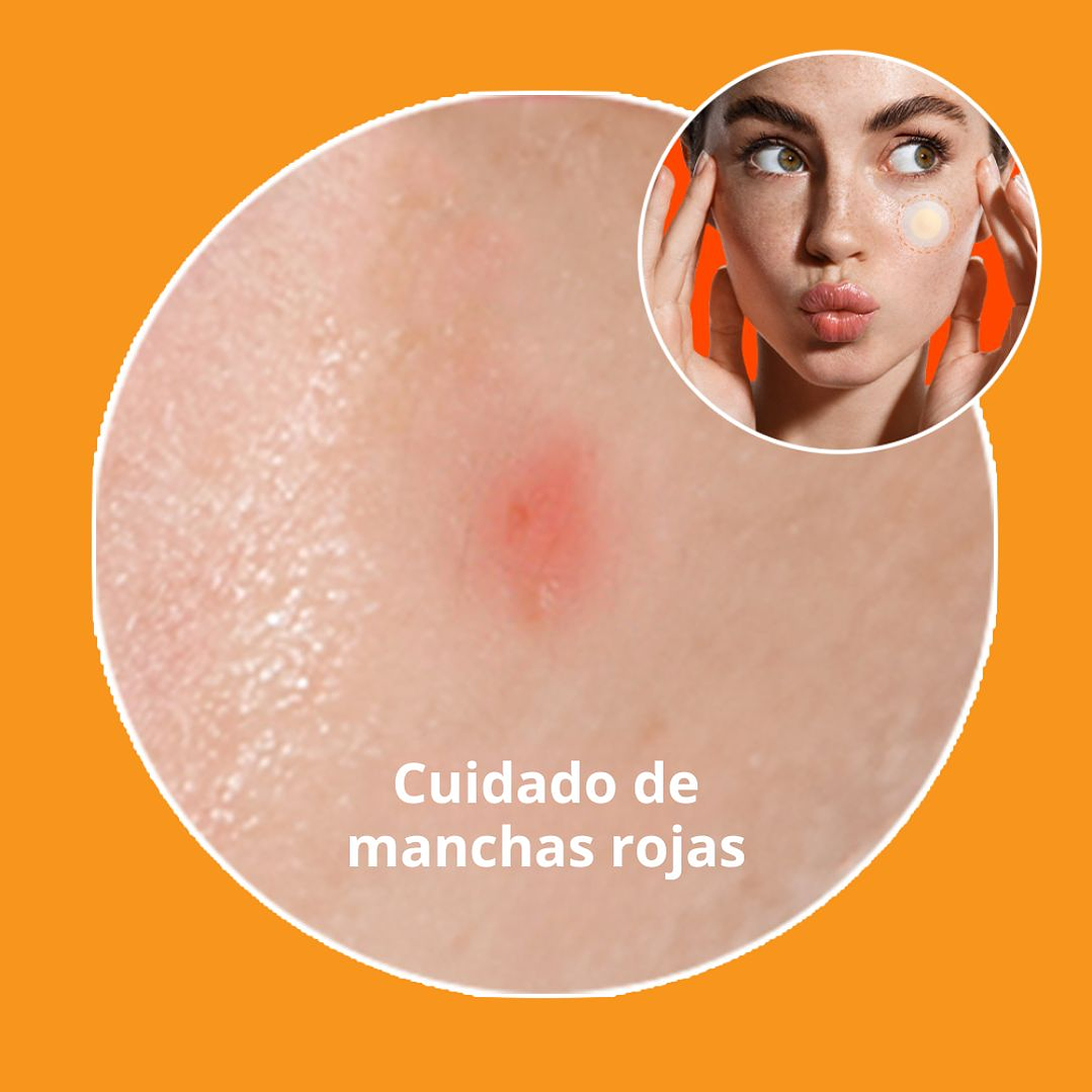 Spot Eraser Orange (Despigmenta/ Ilumina/ Repara) 4