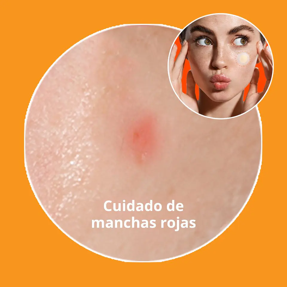 Spot Eraser Orange (Despigmenta/ Ilumina/ Repara) 4