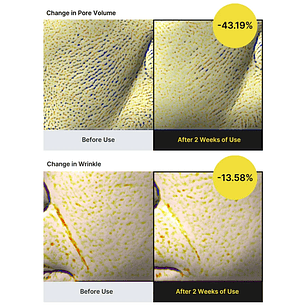 retinol shot The Vita A Retinol Shot Tightening Serum 30ml