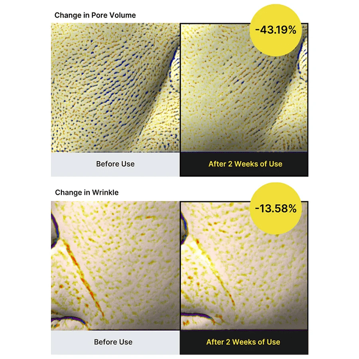 retinol shot The Vita A Retinol Shot Tightening Serum 30ml 2