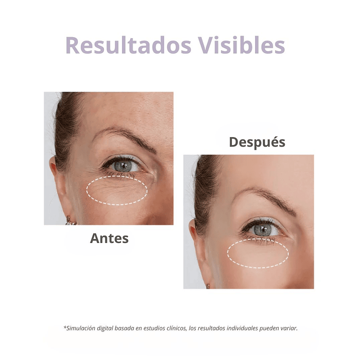 contorno de ojos «Overnight Eye Cream» 7