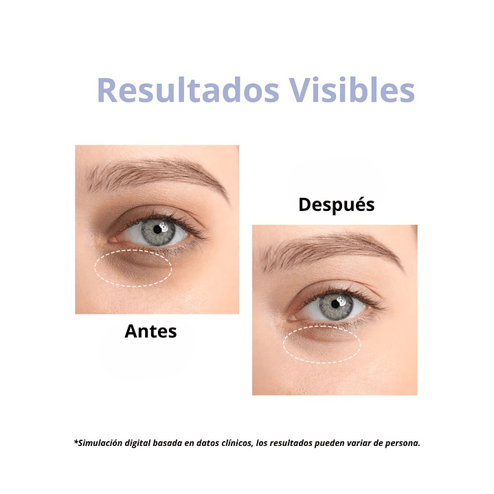 Sérum «Intensive Eye Serum» 6