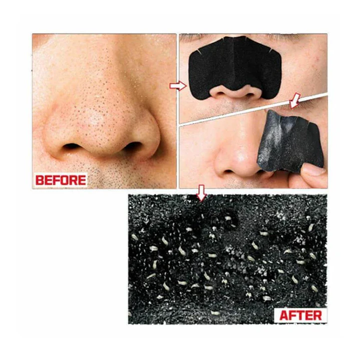 Fuerte Removedor Puntos Negros (Kit 3-en-1) 2