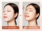PDRN Collagen Hydrogel 1 Mask  - Miniatura 3