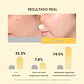 Kojic Acid Turmeric Brightening Gold Jelly Gel Mask - Miniatura 3