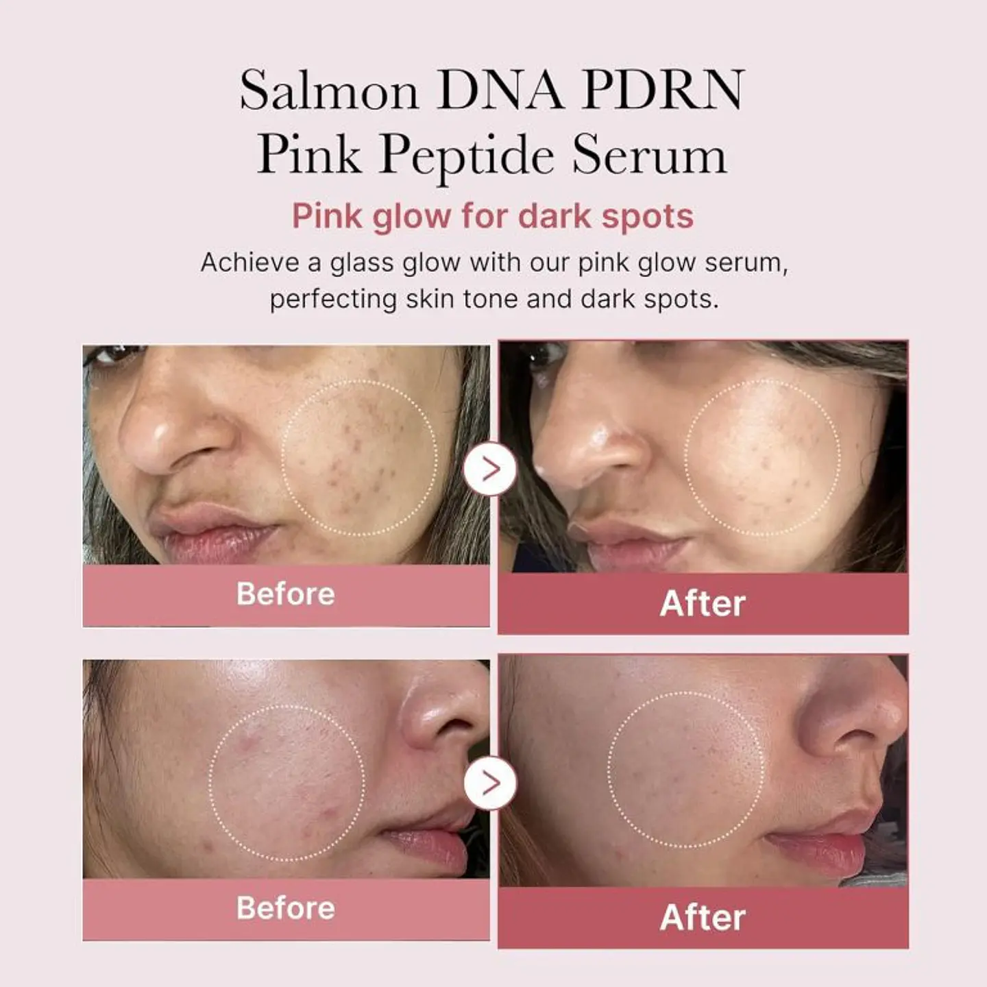 PDRN Pink Peptide Serum 30ml 2