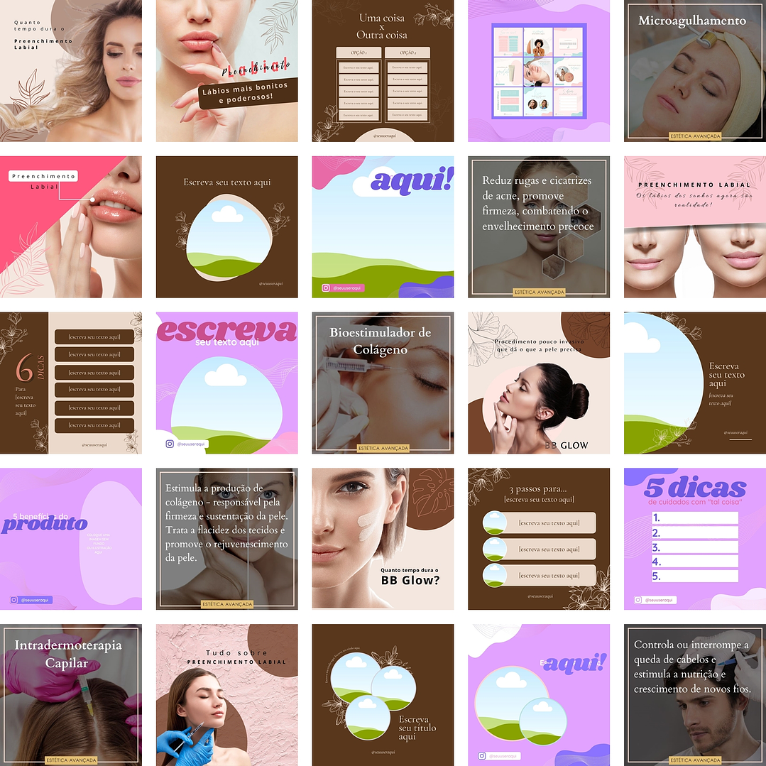 Pack Canva Estética Templates Editáveis 290 Artes + Bônus 2