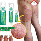✨🌿Crema para Psoriasis – Alivio de la Picazón y Cuidado de la Piel🌿✨ - Miniatura 5