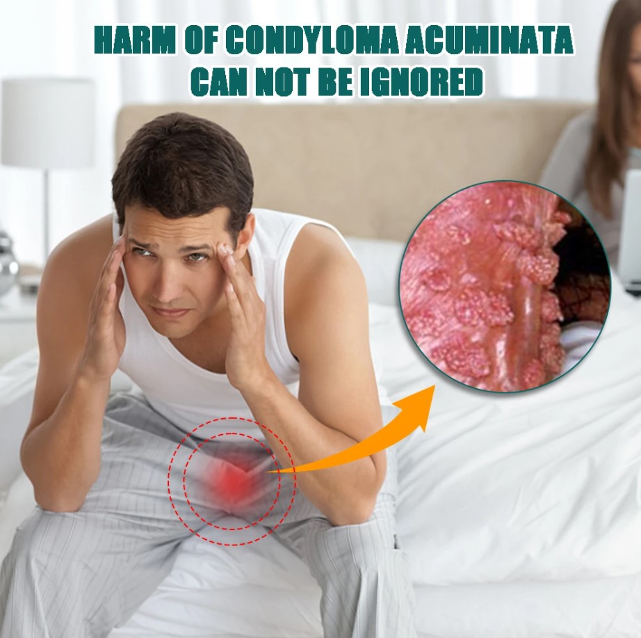 Crema para el Cuidado de la Piel de La zona íntima (Verrugas y Papilomas) – Acción Antibacteriana – 20 g 5