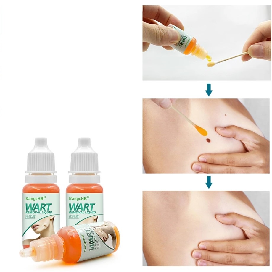Líquido KanyeHB para Verrugas con Extractos Naturales – Uso Tópico (10 ml) 3