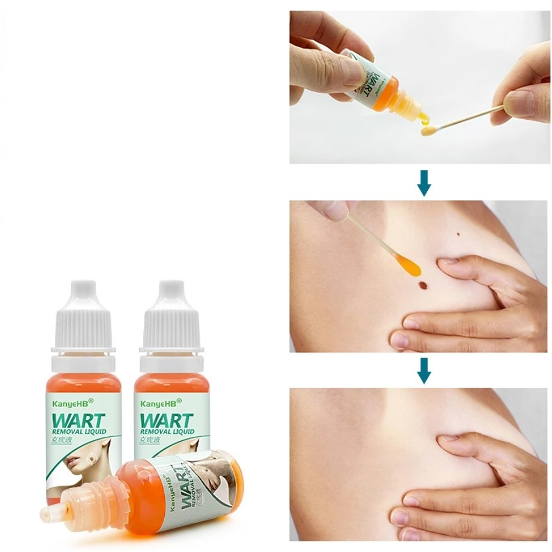 ✨ Ungüento Eliminador de Verrugas y Condilomas – Alivio y Acción Rápida ✨ 2