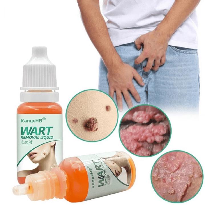 ✨ Ungüento Eliminador de Verrugas y Condilomas – Alivio y Acción Rápida ✨ 5