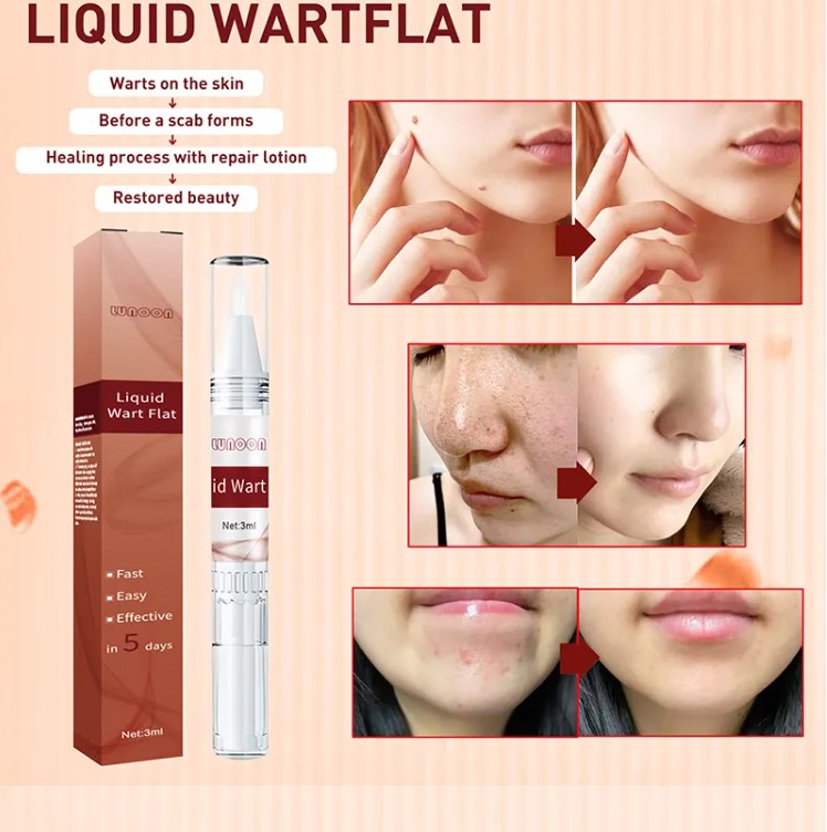 Lápiz Eliminador de Verrugas, Papilomas y Lunares – Fórmula Natural 3