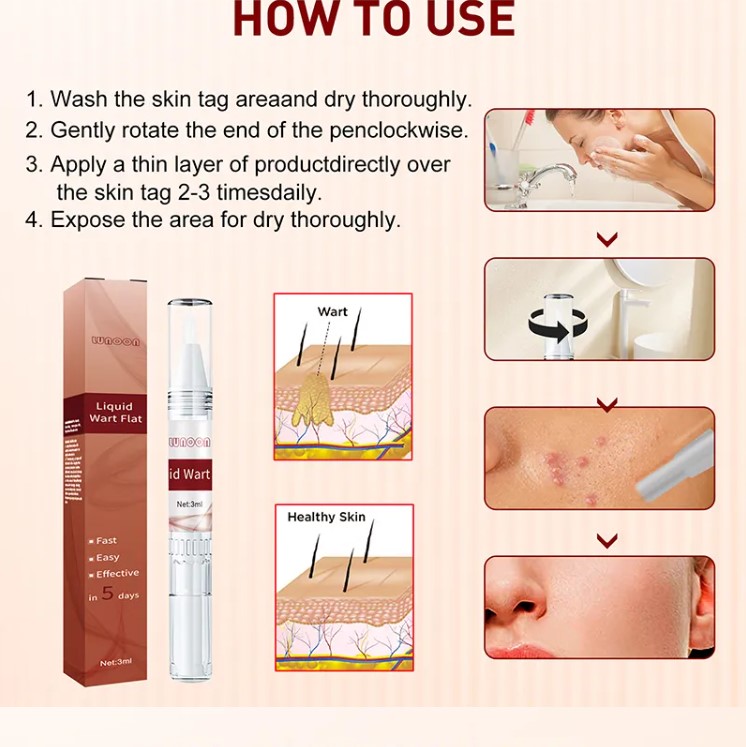 Lápiz Eliminador de Verrugas, Papilomas y Lunares – Fórmula Natural 4