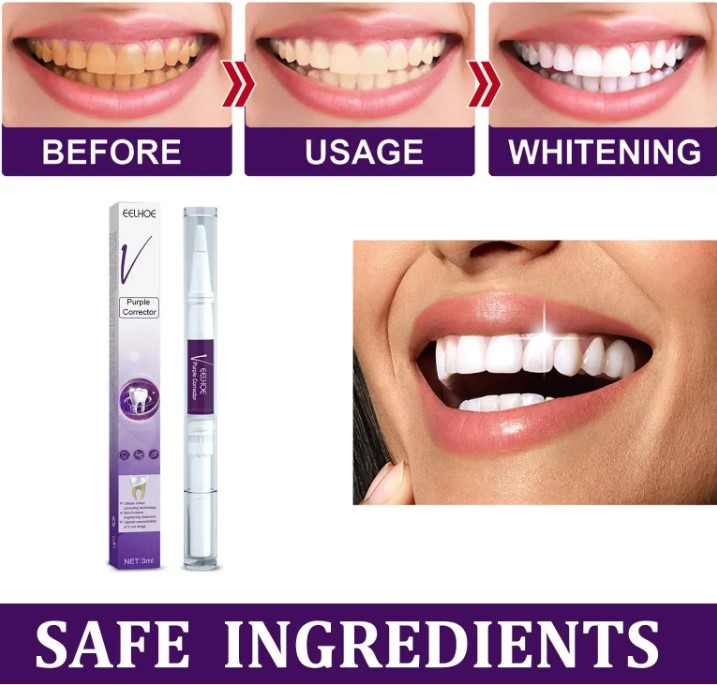 Lápiz Gel de Dientes – Uso Dental Cosmético 3