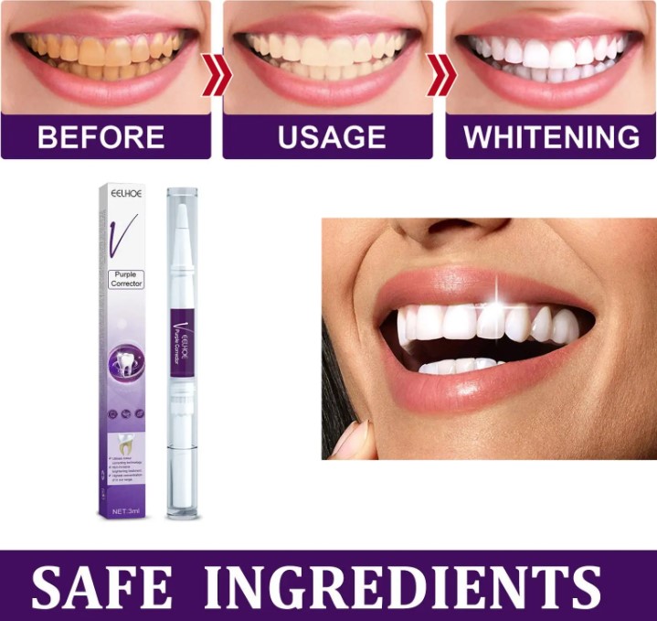 Lápiz Gel de Dientes – Uso Dental Cosmético 4