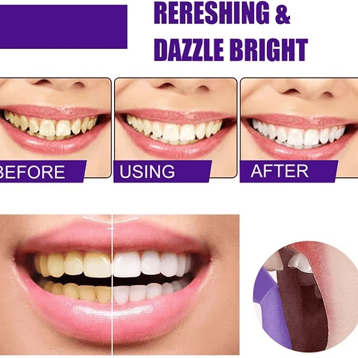 ✨ Mousse Dental V34 – Blanquea y Refresca tu Sonrisa ✨ 4