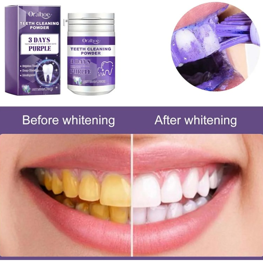 🌟 ¡Sonríe sin manchas! Polvo Blanqueador de Dientes – Efecto rápido y seguro🌟 4