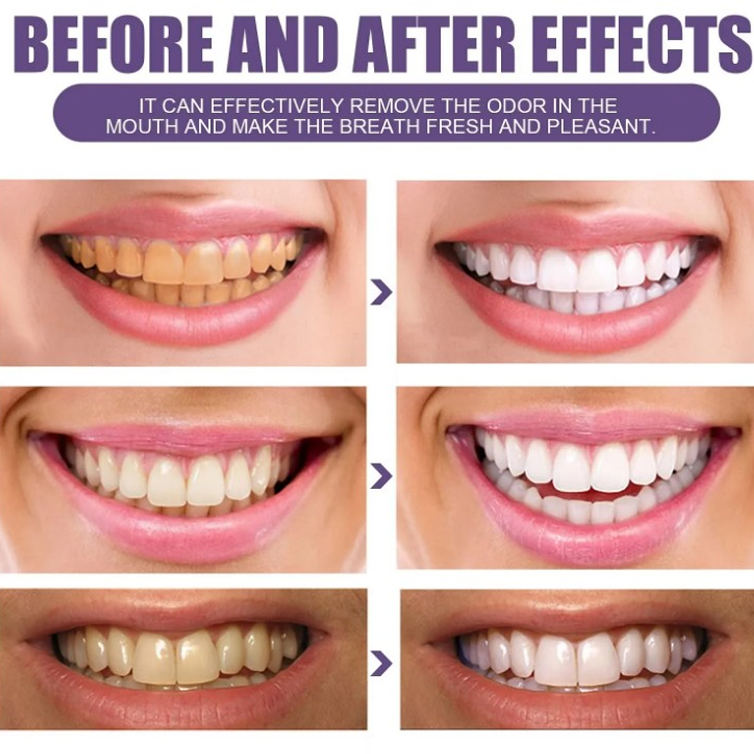 🌟 ¡Sonríe sin manchas! Polvo Blanqueador de Dientes – Efecto rápido y seguro🌟 5