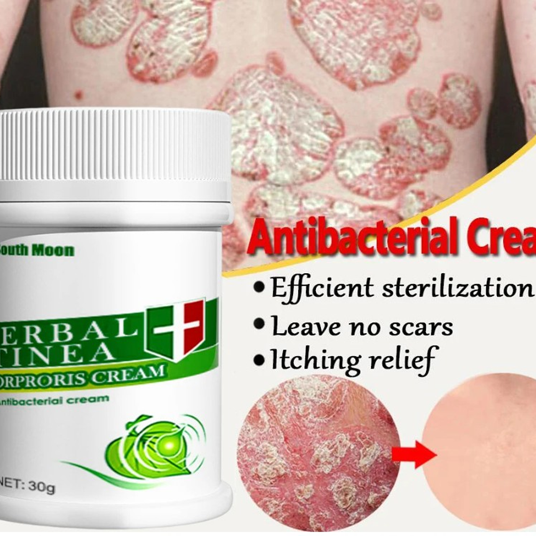 🌱 Crema Herbal para Psoriasis, Dermatitis y Eczema – Antibacteriana y Antipicazón🌱 2