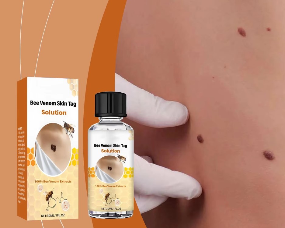 Solución South Moon para Skin Tags y Verrugas con Extractos Naturales – Uso Tópico (30 ml) 2