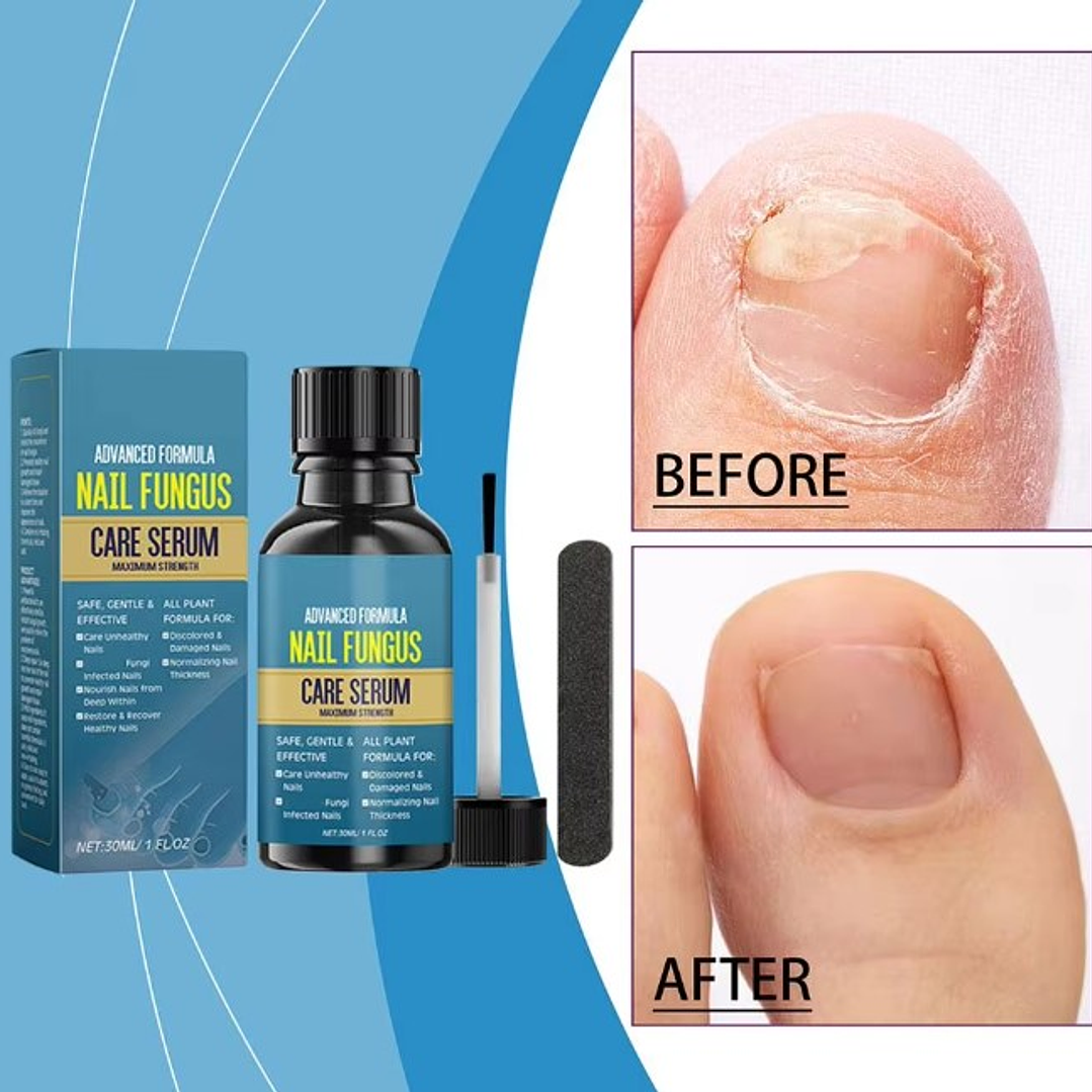 ✨💅Gel con Solución Anti Micosis Antihongos – 30 ml + Lima de Uñas💅﻿✨ 5