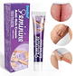 ✨ Bienestar íntimo, alivio inmediato. Tratamiento de la Vaginitis (HBESTY, 20 g) ✨ - Miniatura 2