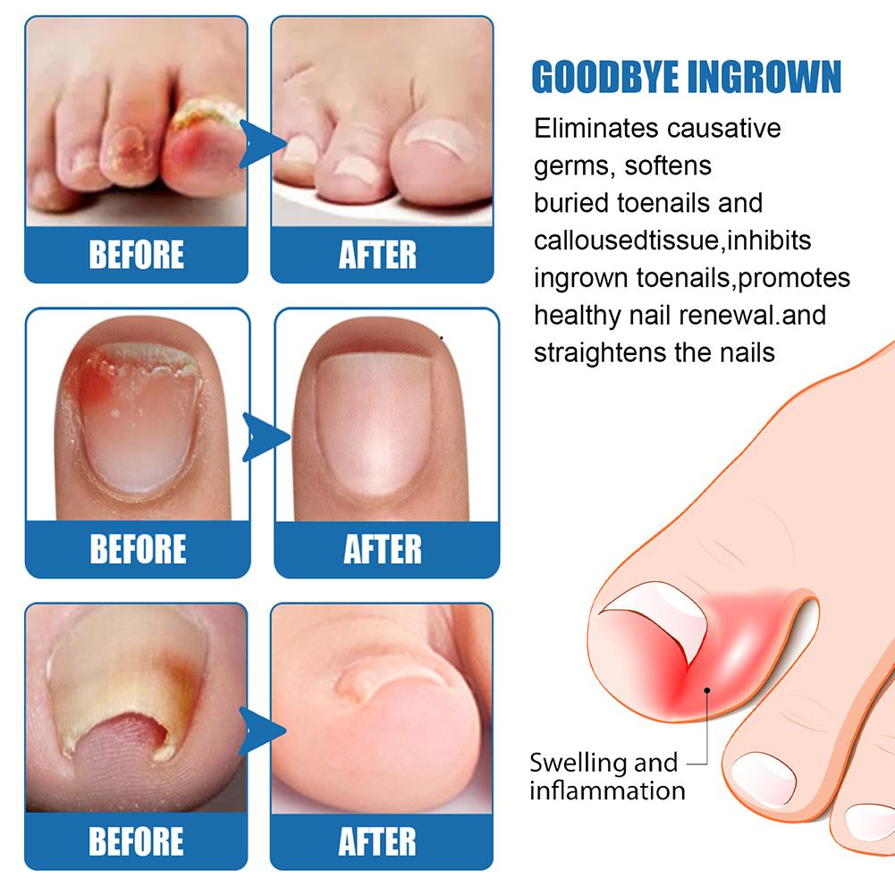 Lápiz Reparador de Uñas South Moon 3 ml 2